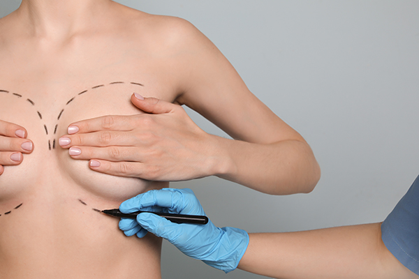 Mejorar cicatrización de cirugía de la mama