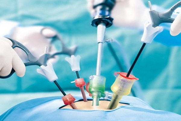 Cirugía laparoscopia cicotrización