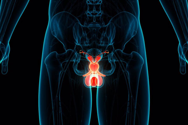 Cirugía cancer de prostata